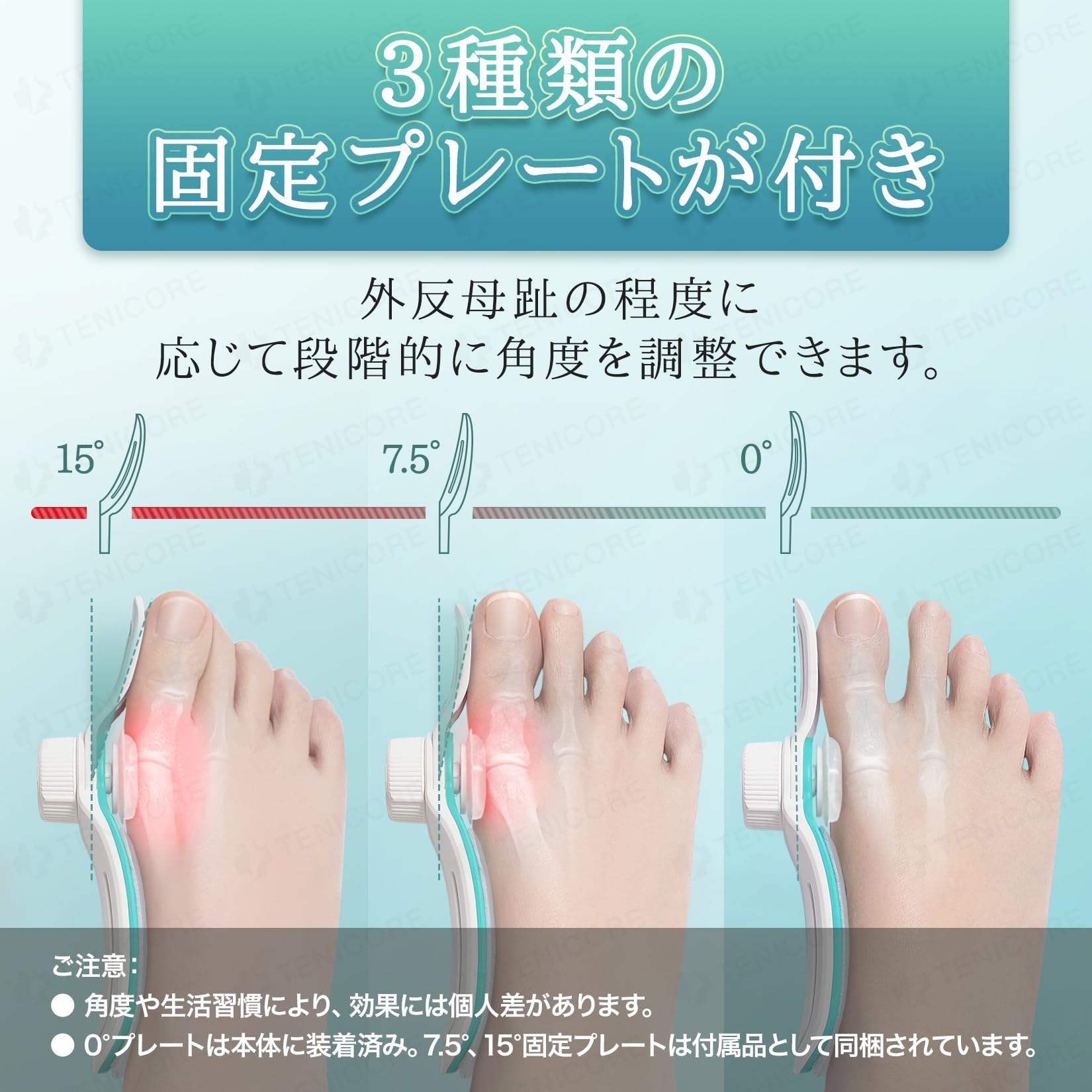 Amazon | 【二重調整の外反対策】Tenicore 外反拇指サポーター