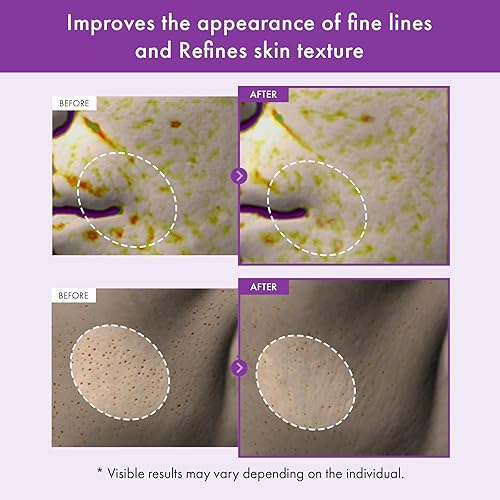 Miniatura 4 de TOSOWOONG Crema de Noche Real de Retinol 0.1%, Hidratante Facial Anti-Edad con Retinol, Bakuchiol, Piel Más Firme, Reduce Arrugas y Minimiza Poros