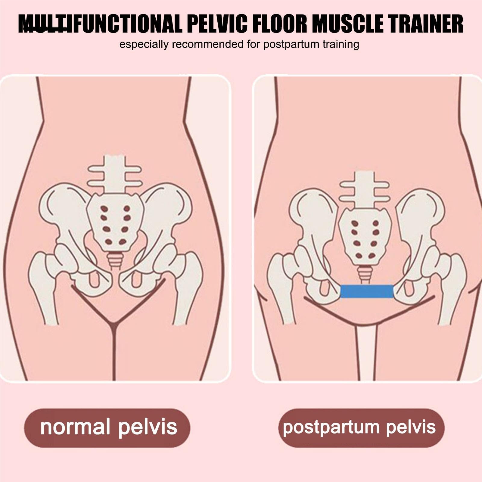 Allenatore Pavimento Pelvico Donna - Eserciziatore Kegel Per Tonificazione E Recupero Postpartum