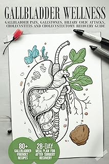 Gallbladder Wellness: The Ultimate Guide to Eliminating Gallbladder Pain, Managing Gallstones, Inflammation, Biliary Colic Attacks, Sludge, Polyps, ... Diet Guides for Weight Loss and Wellness)