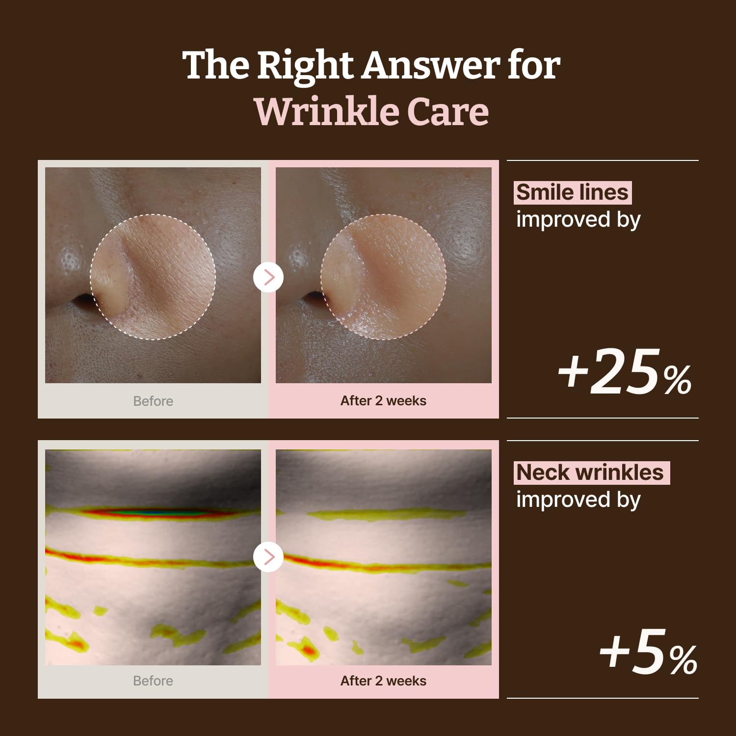 Dr. Reju-All Advanced PDRN Rejuvenating Mask - Face & Neck Korean Sheet Mask with 1,200 ppm PDRN, Collagen & Copper Peptides - Hydrating & Soothing, Skin Repair (36g x 4EA) - 4