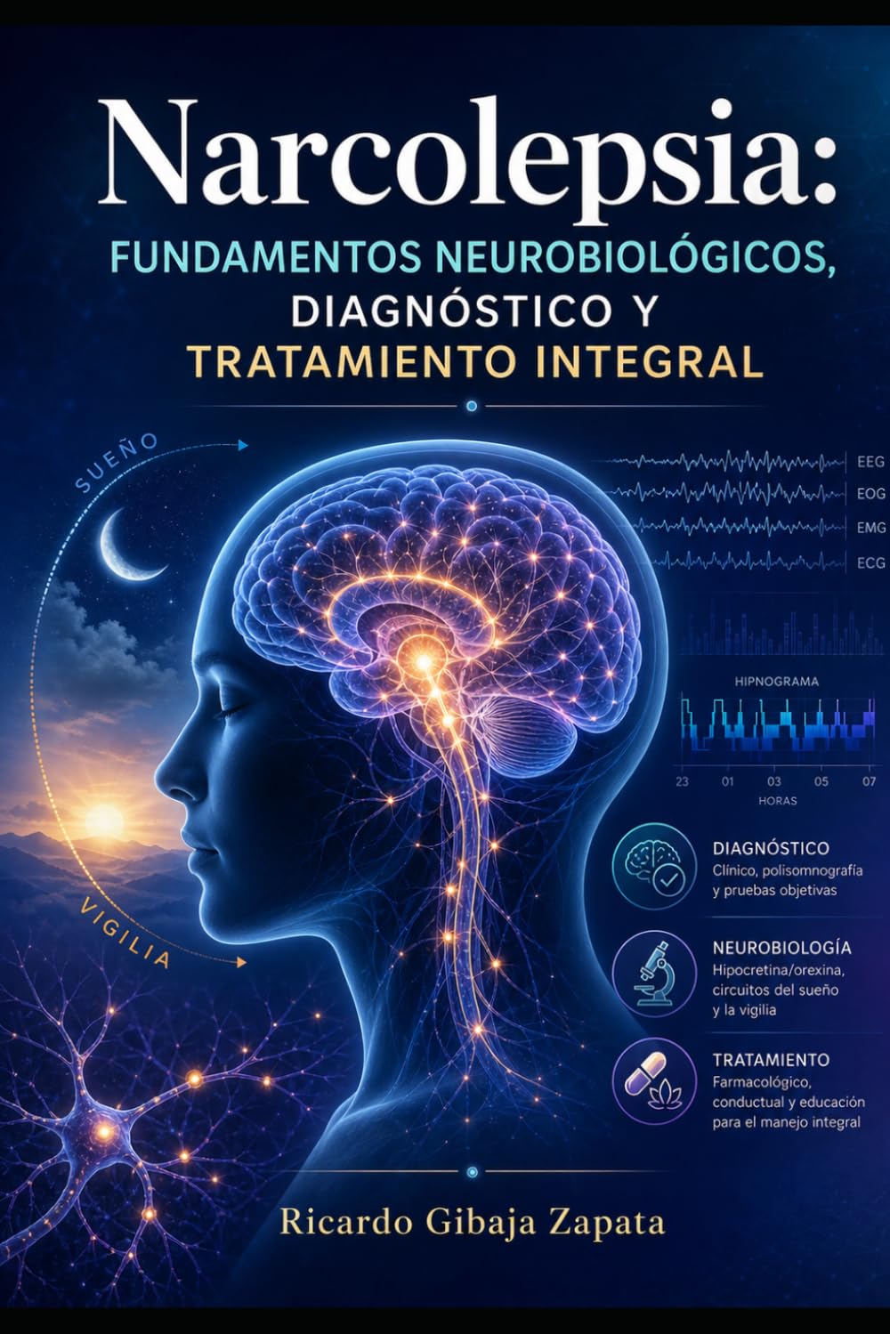 Narcolepsia Fundamentos Neurobiológicos, Diagnóstico y Tratamiento Integral