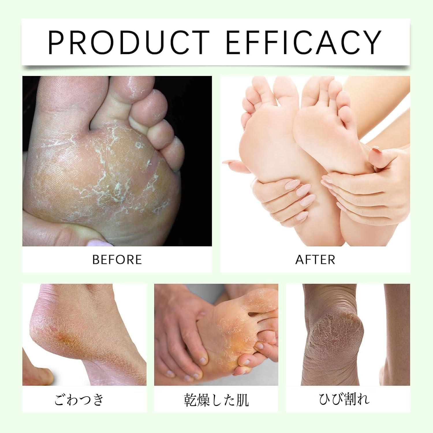 Amazon.co.jp: 尿素クリーム60% 足用【フットケア衛生管理士共同開発