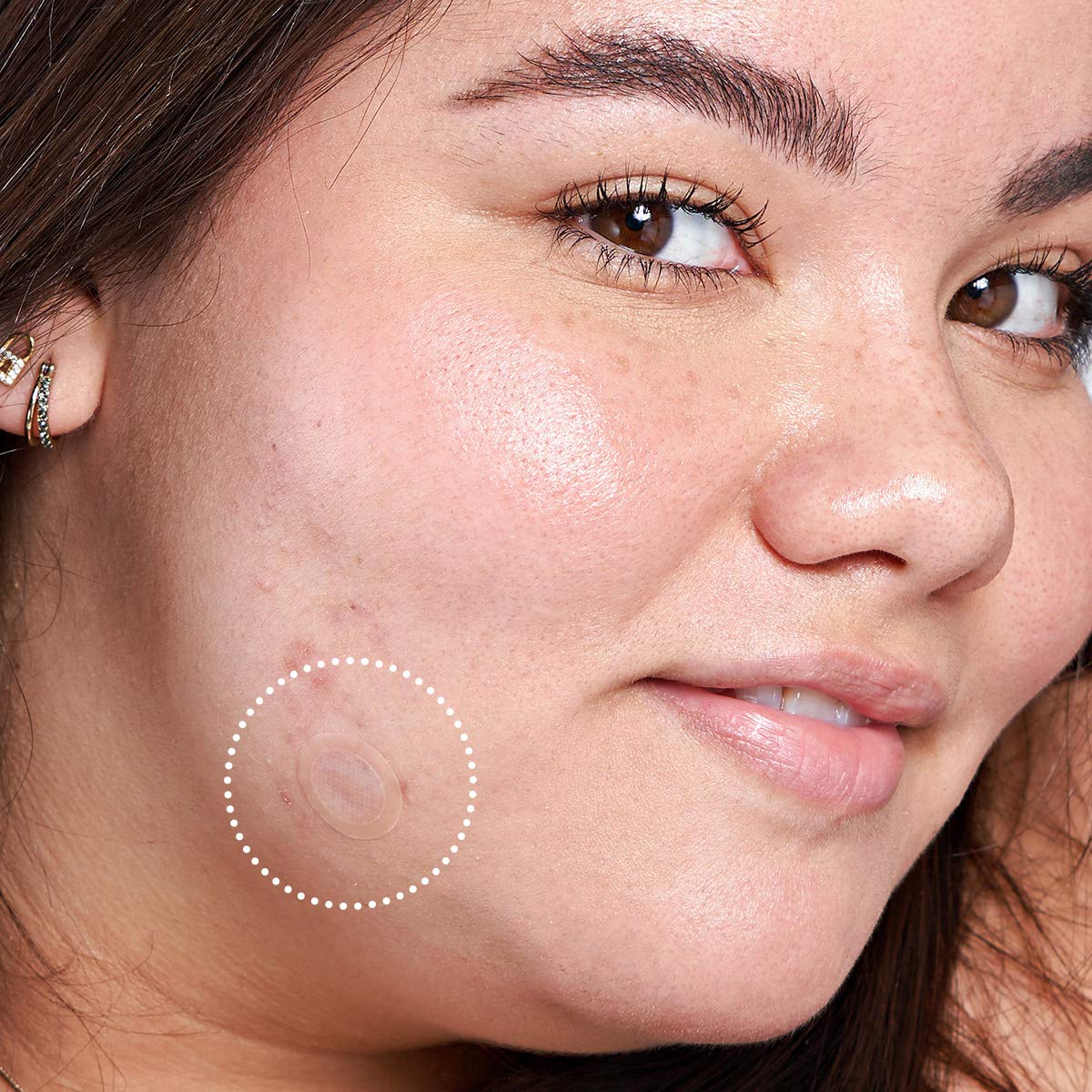 Mighty Patch Micropoint for Dark Spots - Hydrocolloid Post-pimple Dark Spot Brightening Patch (6 Patches) : Beauty & Personal Care