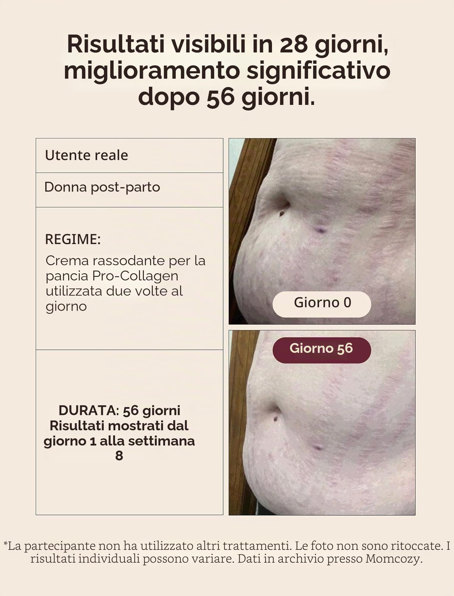 Momcozy Crema Smagliature e Rassodante Pancia 4-in-1,Trattamento con Peptidi Pro-Collagene,Idratante, Rassodante ed Elasticizzante per Gravidanza e Post Parto,150g