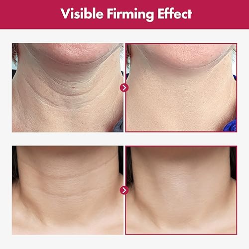 Miniatura 3 de TOSOWOONG Crema de colágeno Necktox con colágeno y ácido hialurónico para reafirmar el cuello, antienvejecimiento, arrugas y tensamiento, cuidado de