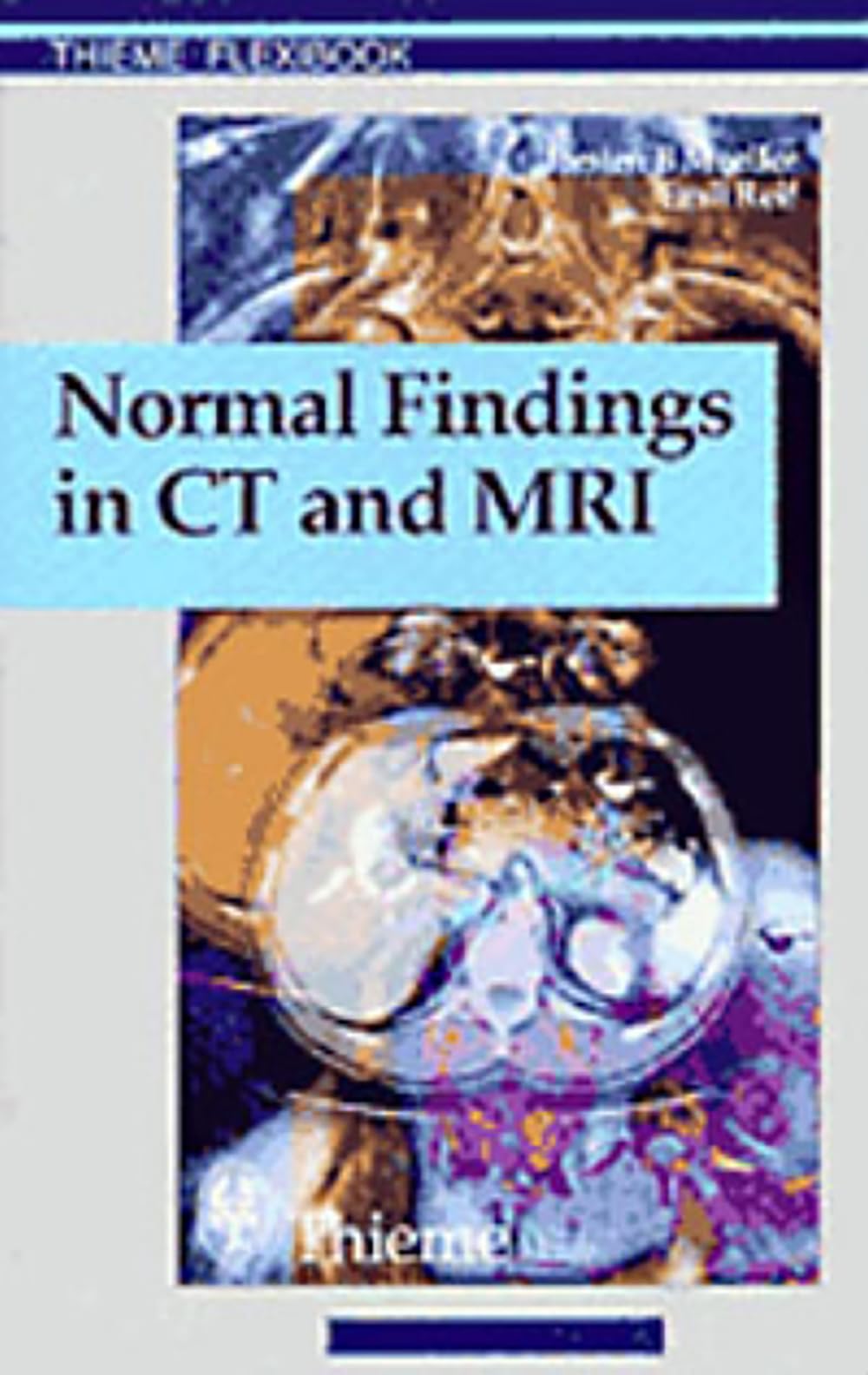 Snapklik.com : Normal Findings In CT And MRI, A1, Print