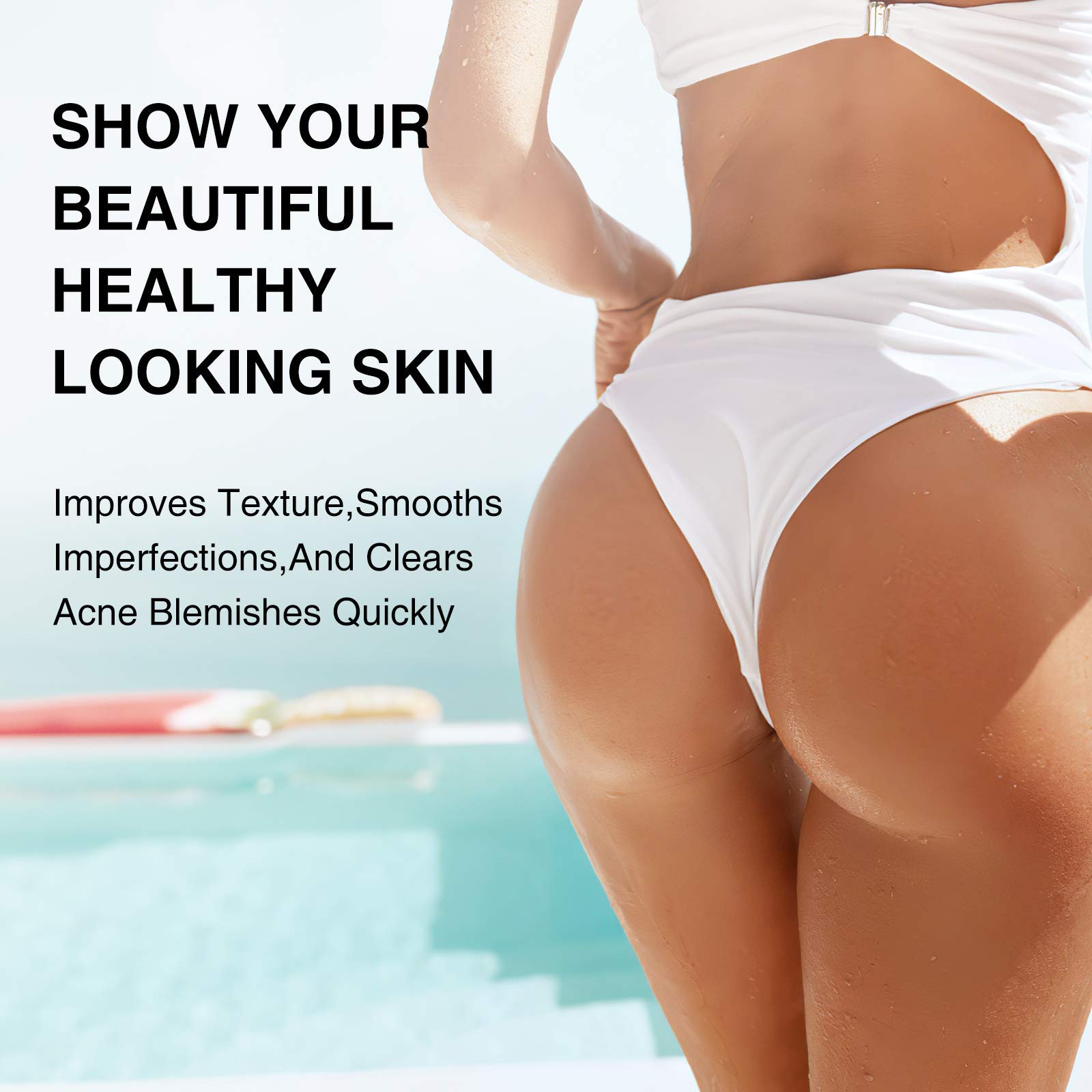 Crema antiacné para glúteos y muslos, crema para el acné corporal, elimina el acné, espinillas y pelos encarnados para glúteos, muslo, zona de espalda y pecho, tratamiento de acné y acné quístico, 3