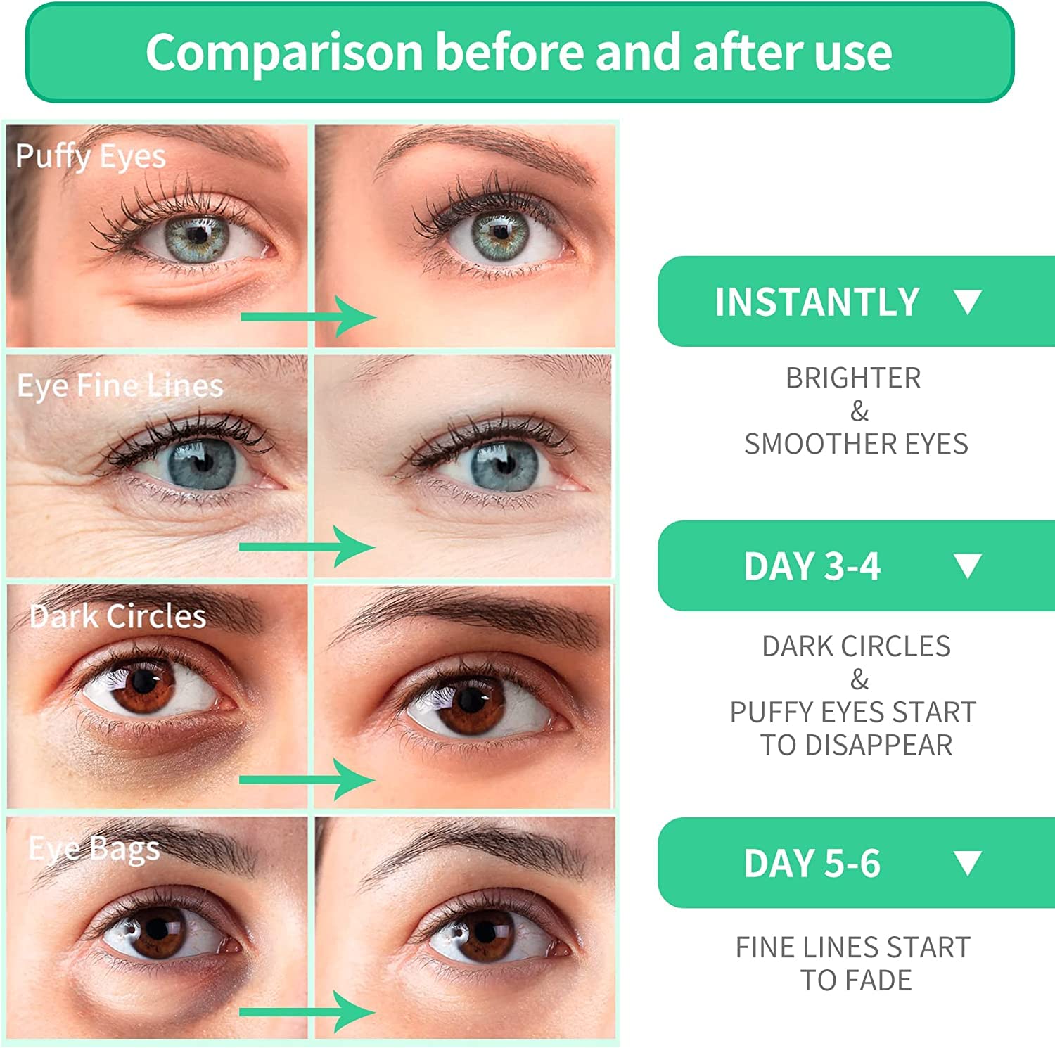 BREYLEE Aloe Vera Eye Mask– 60 Pcs - Puffy Eyes and Dark Circles Treatments – Look Younger and Reduce Wrinkles and Fine Lines Undereye, Improve and Firm eye Skin - Pure Natural Material Extraction : Beauty & Personal Care