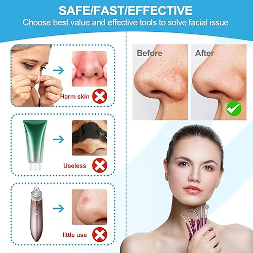 Miniatura 4 de Herramientas removedoras de puntos negros, raspador facial para limpieza profunda, kit de herramientas para reventar espinillas, espátula facial,