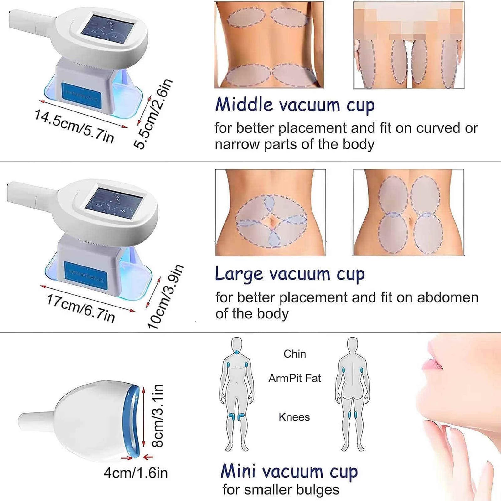 Dispositivo per Modellamento del Corpo, Dimagrimento E Lipolisi, Macchina per Congelamento del Grasso, Crioterapia a 360° Macchina, Massaggiatore per La Rimozione della Cellulite