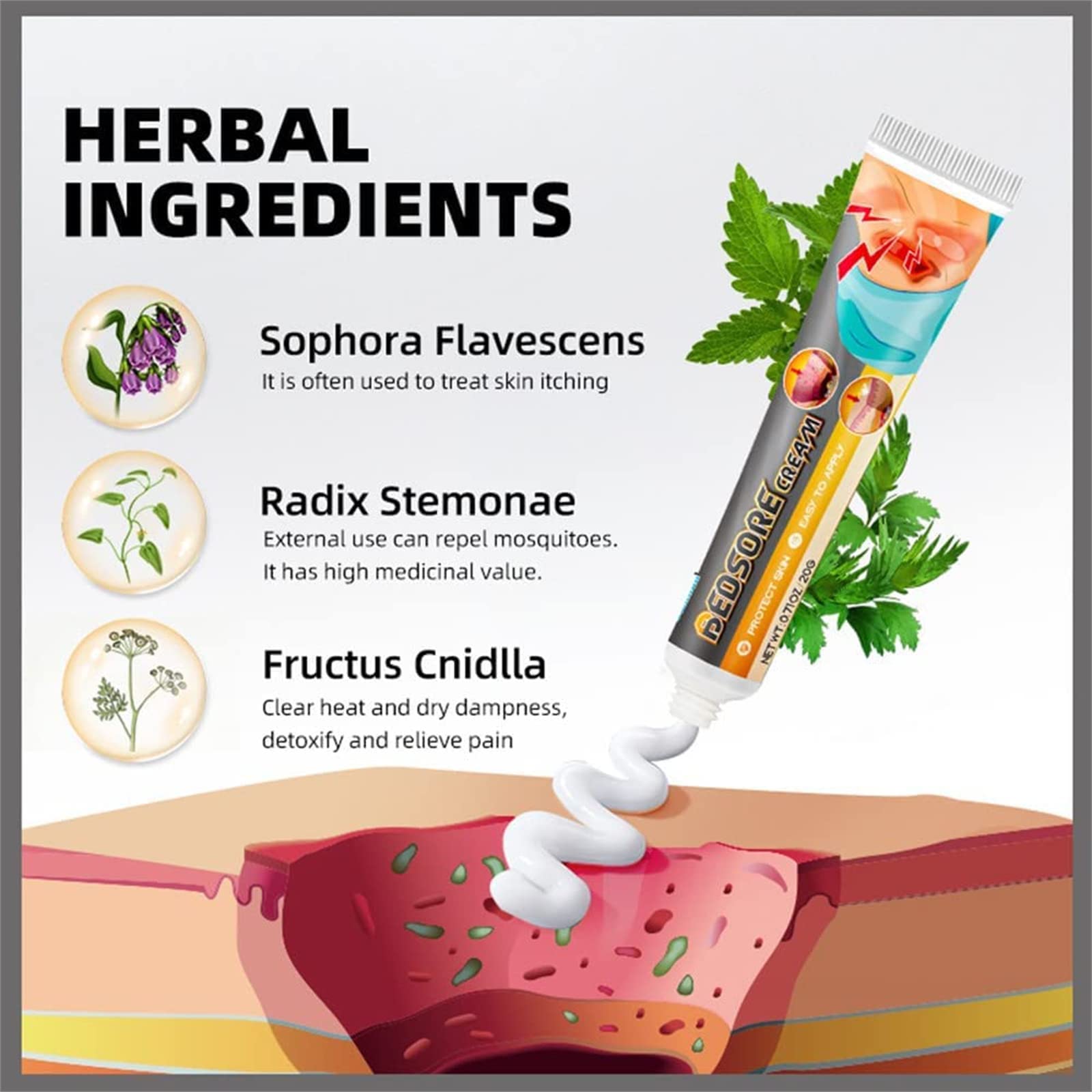 Krem do leczenia bólu łóżka, organiczny odleżyn, maść, odleżyna, krem łagodzący ból odleżyn, pielęgnacja ran w leczeniu odleżyn, leczenie odleżyn, gojenie się ran