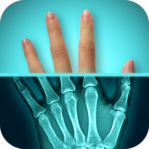 Amazing XRay App on the Amazon Appstore