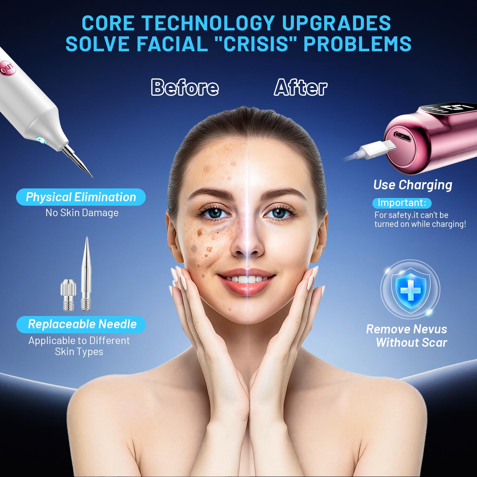 KSWEGKC Skin Tag Remover Device,Skin Tag Removal with Precision Spot Treatment,Portable Tool for Small Blemishes,Easy At-Home Skin Care Use - Pink - 3
