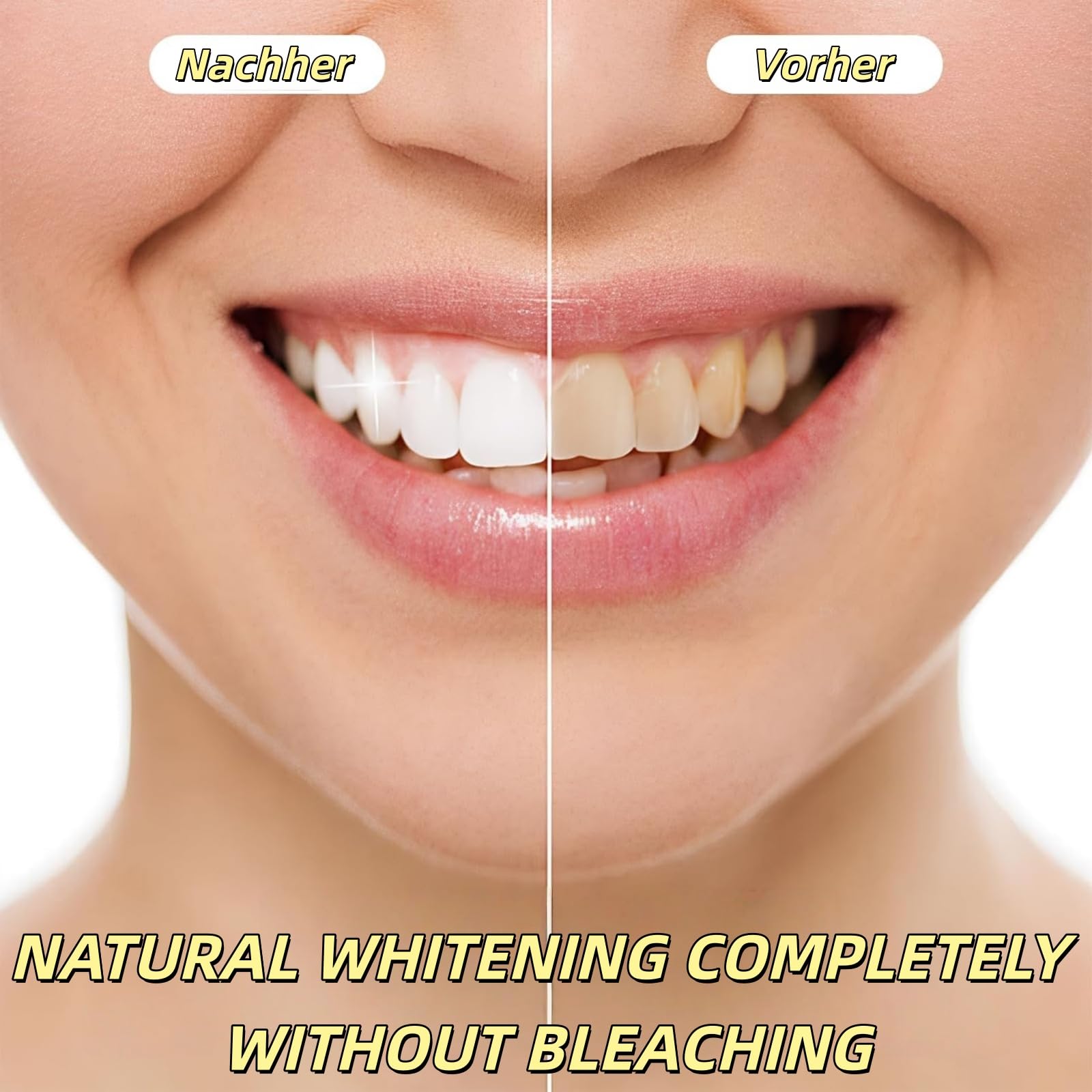 GlowDent - Strisce sbiancanti dei denti, 42 pezzi, viola e antiscivolo, per rimuovere rapidamente tutti i tipi di scolorimento dei denti (2 pezzi, 42 pezzi)
