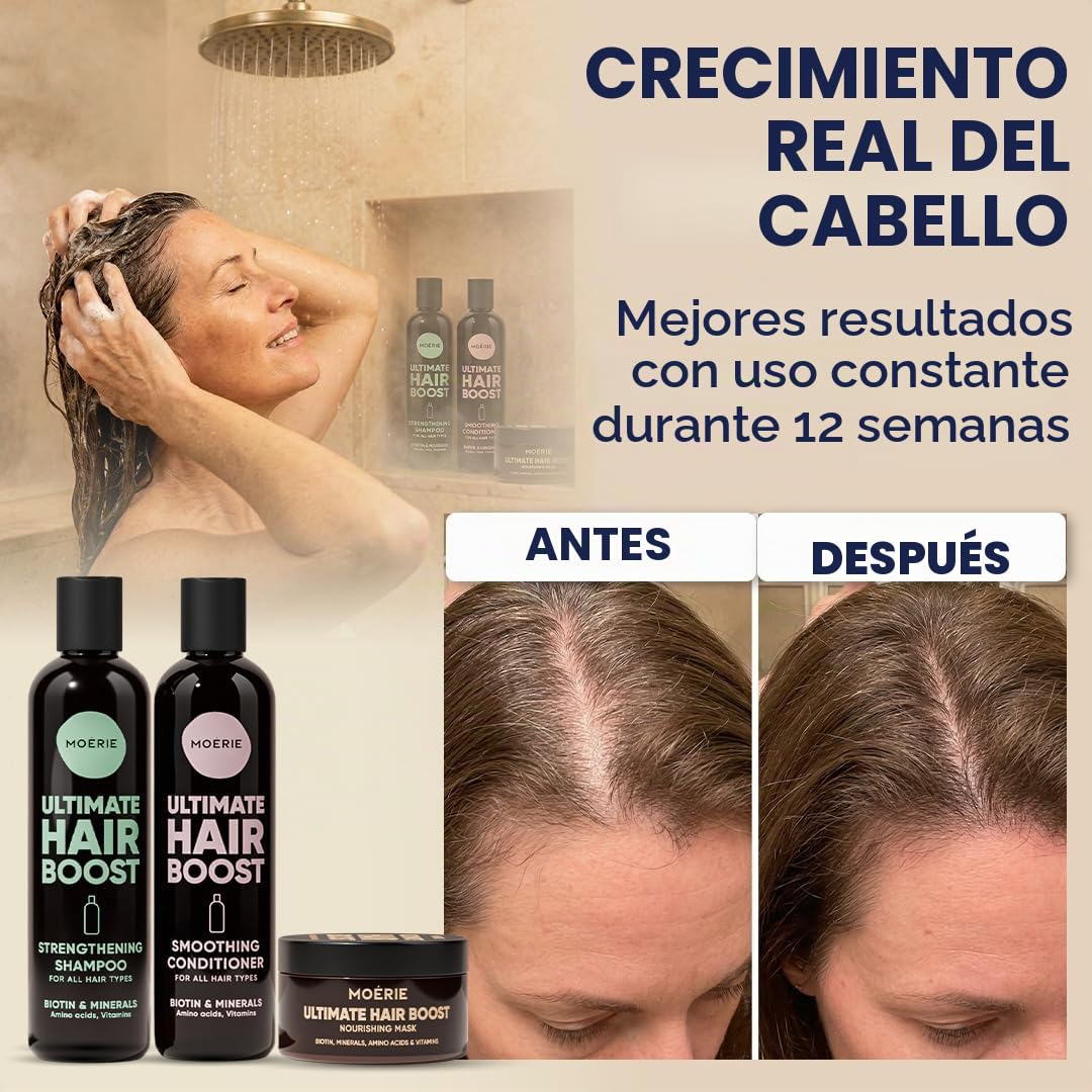 MOERIE Juego de champú de 3 piezas – Champú para el crecimiento del cabello, acondicionador y mascarilla contra la caída del cabello, acelerar el crecimiento del cabello de forma natural, remedio