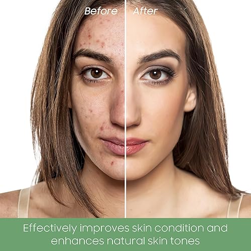 Miniatura 2 de Mascarilla de limpieza profunda de té verde, removedor de puntos negros para cara, limpieza profunda de poros, control de aceite e hidratación con