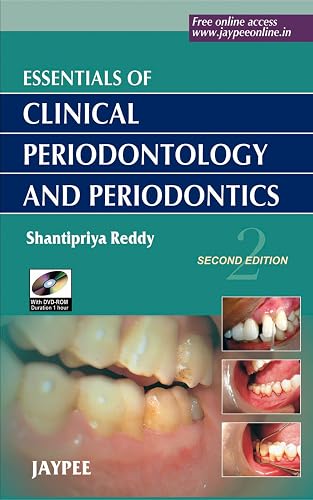 Essentials of Clinical Periodontology and Periodontics