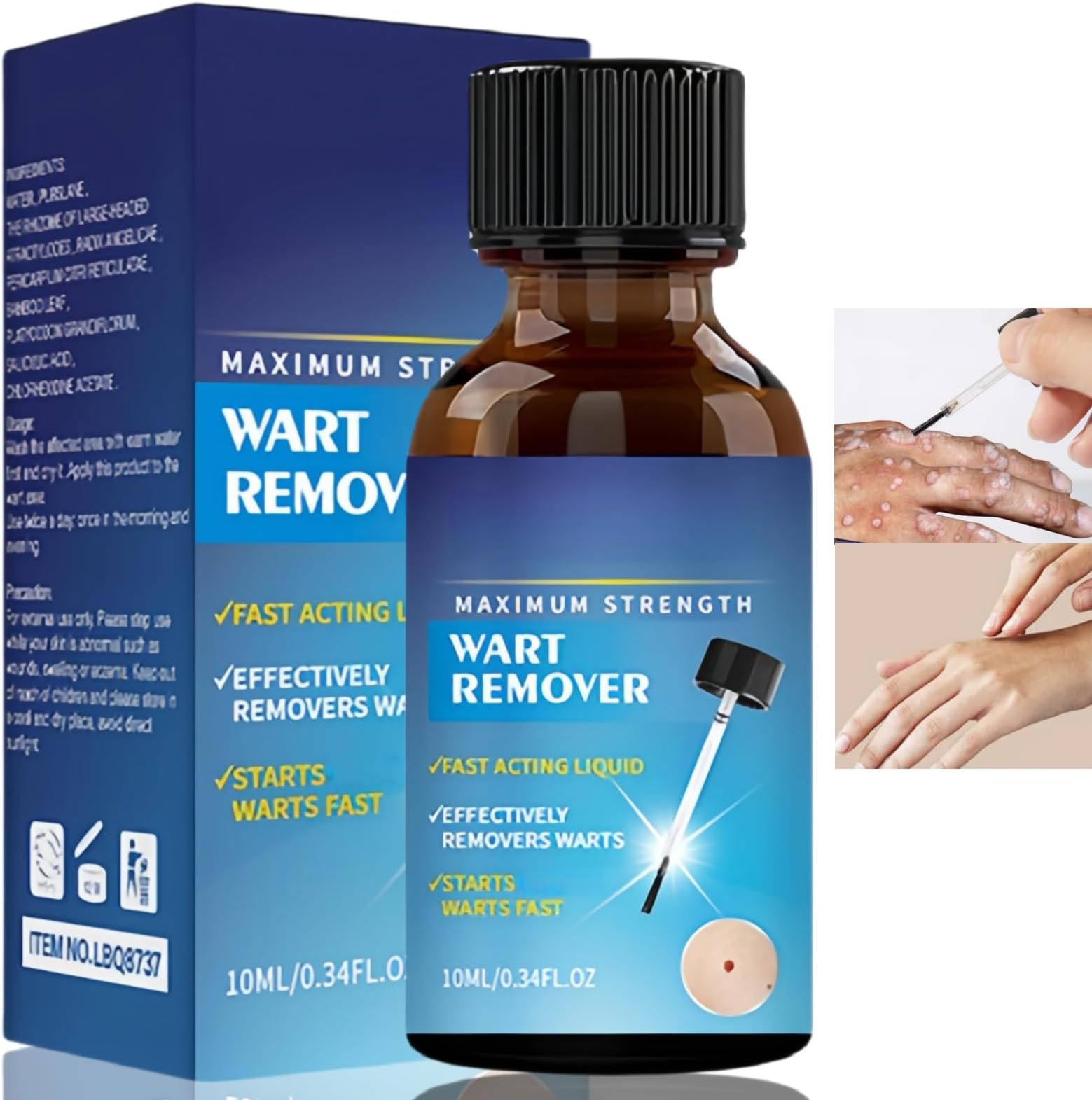 Wart Remover Fast Acting and Painless,Mole Remover,Wart Remover for Face,Skin Tag Remover for Hands and Body Fall Away Quickly,Wart Remover Liquid,Tag Remover Skin for All Skin Types,Warts Removal