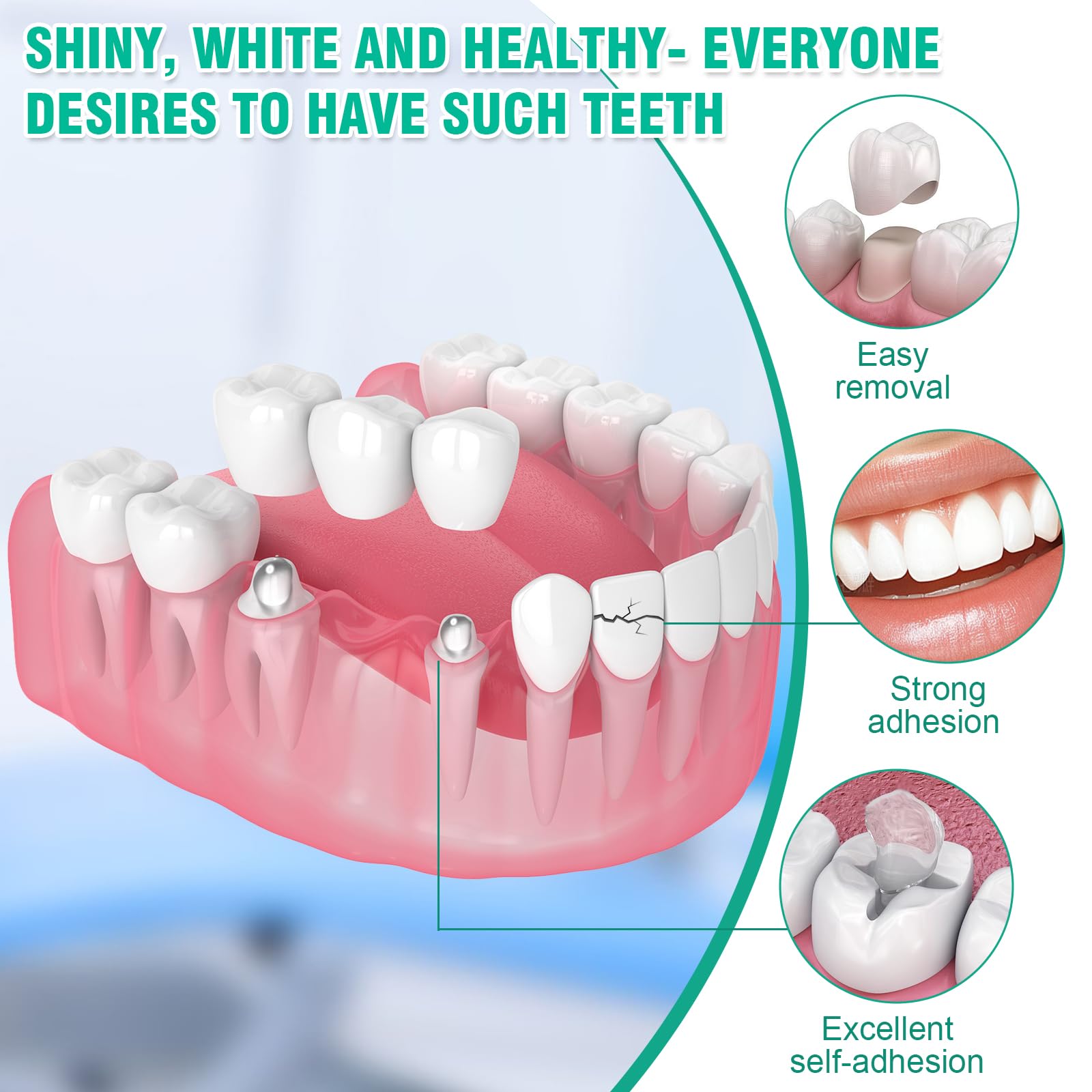 Cemento Dental Composite Kit de Fijación para Corona y Puente