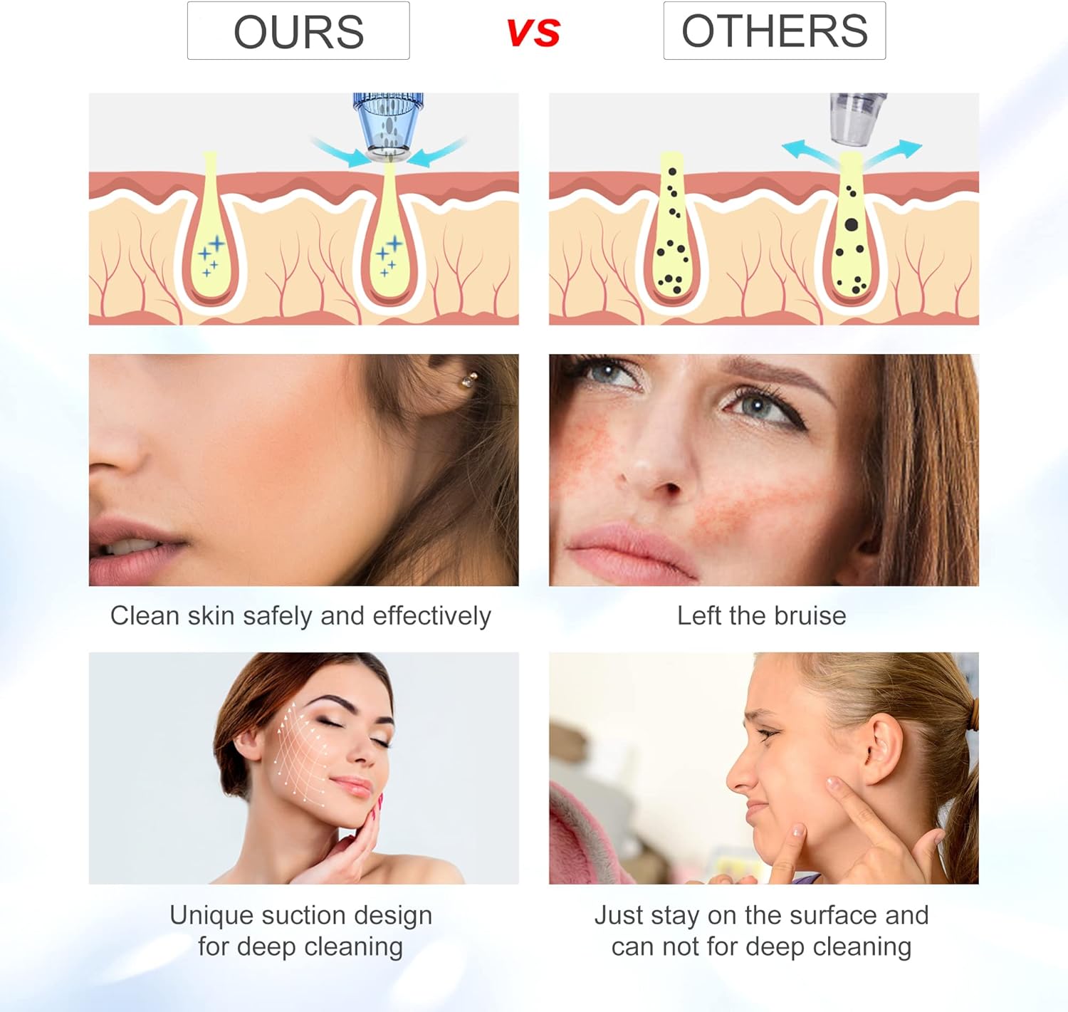 Blackhead Remover Pore Vacuum - Upgraded Electric Pore Cleaner Blackhead Removal Tool with 5 Adjustable Suction Power and 4 Suction Probes, USB Rechargeable Pore Vacuum Removal for Whitehead (White) : Beauty & Personal Care