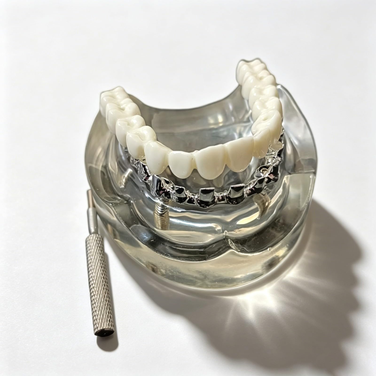 Modello di impianto dentale overdenture mascella inferiore rimovibile con 6 impianti per studio didattico - Strumento di dimostrazione della visione trasparente