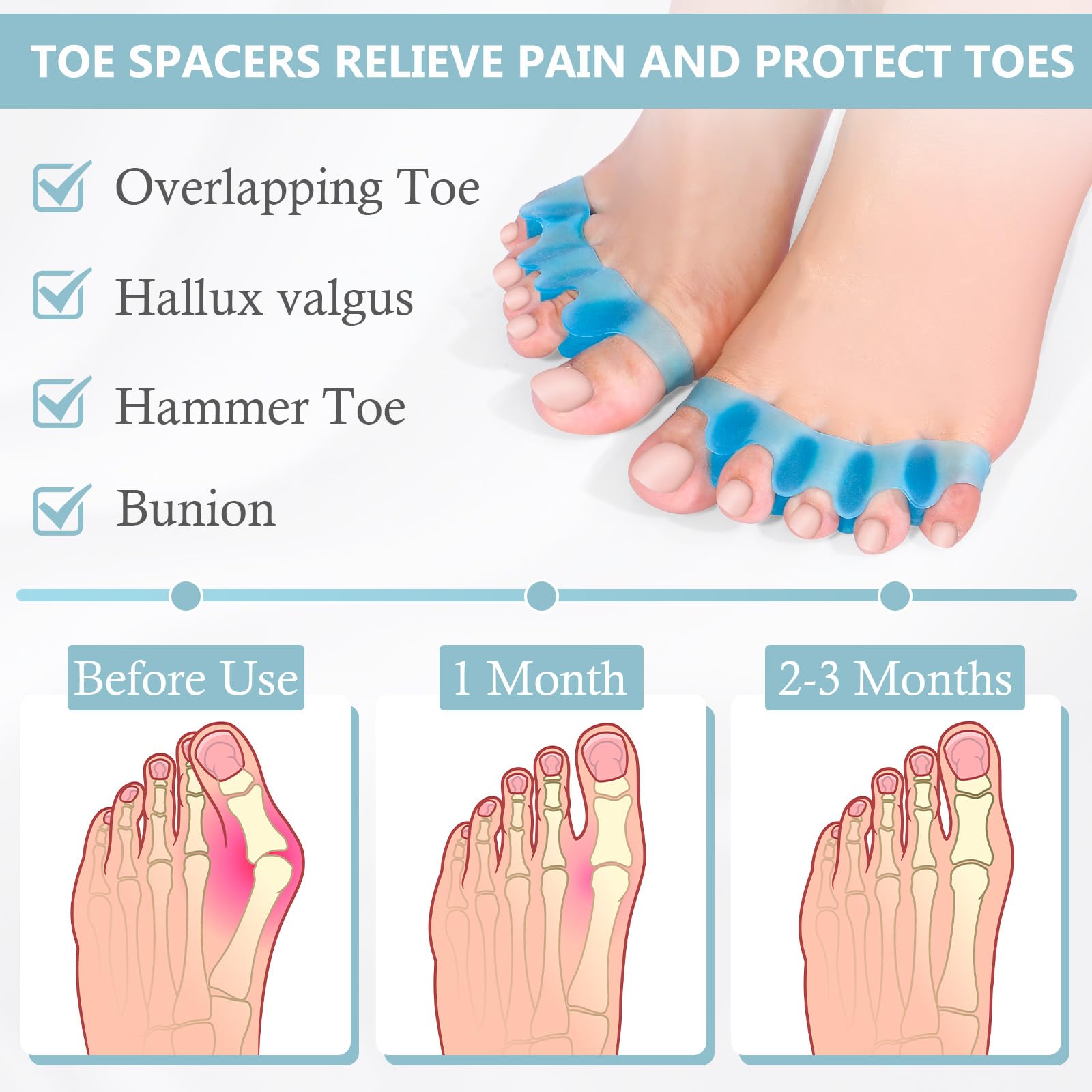 Condition photo showing Brand New for Toe Separators for Women and Men, Gel Toe Spacers for Pedicure and Foot Alignment, Comfortable Foot Care for Bunions and Overlapping Toes