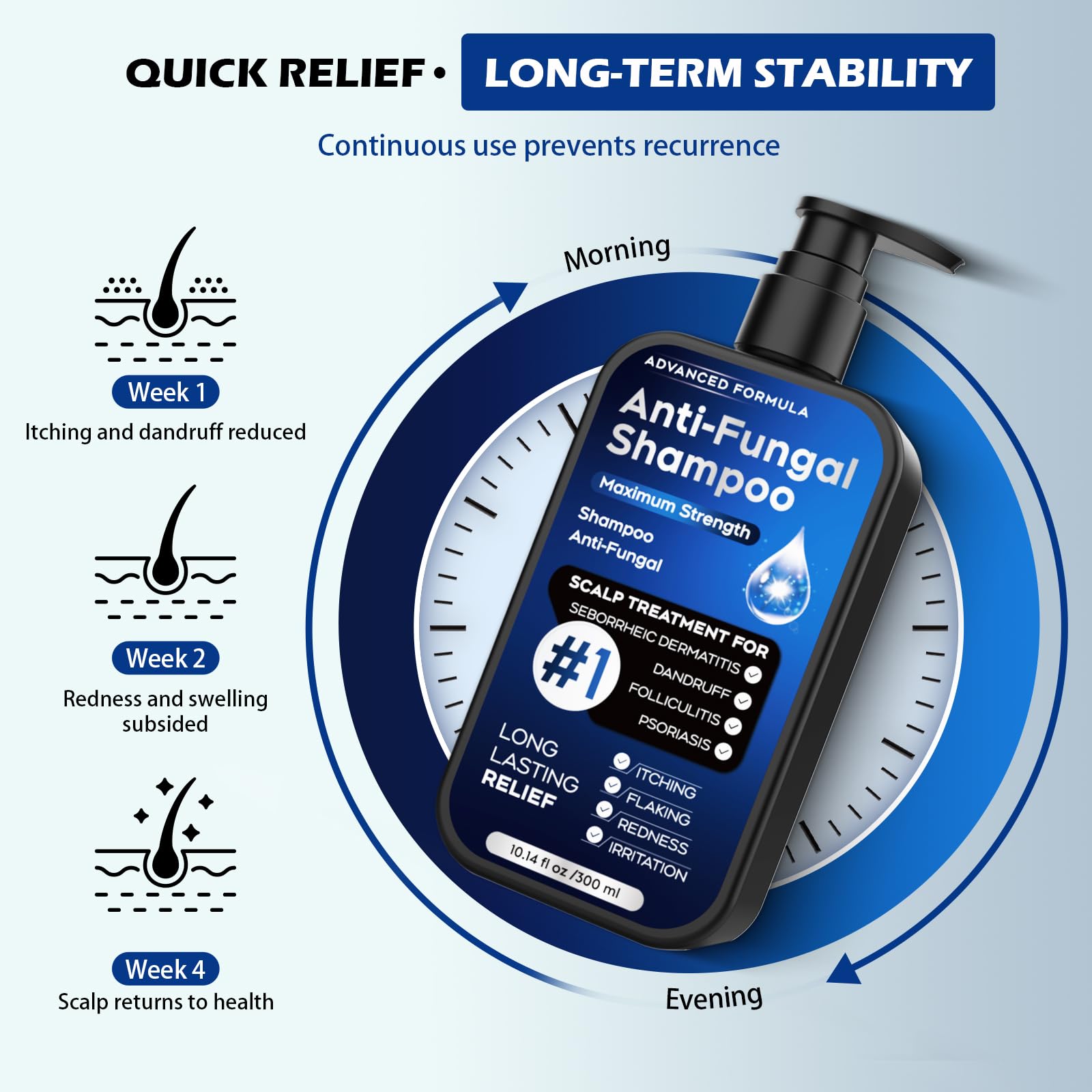 Champú antifúngico para dermatitis seborreica, foliculitis y psoriasis del cuero cabelludo, champú anticaspa para hombres y mujeres, alivia la picazón del cuero cabelludo, la sequedad, sin sulfatos ni 7