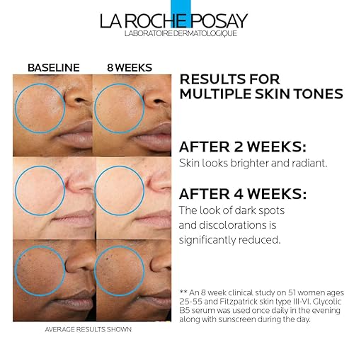 Miniatura 2 de La Roche-Posay, Mela-D Pigment, Suero para control de manchas oscuras con ácido glicólico, 1.01 fl
