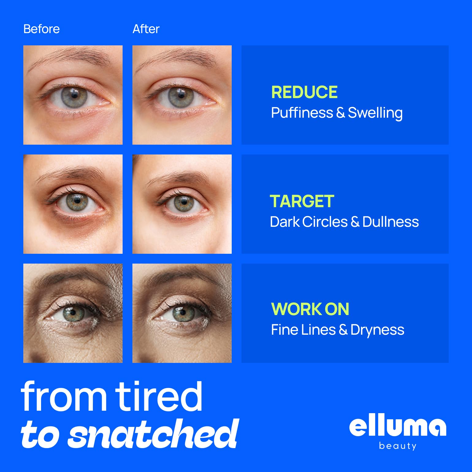 Under Eye Patches 12 Paar Themed Hydrogel Eye Gel Pads - Für Geschwollene Augen und Augenringe, Unter Augen Tränensäcke, Falten - Restoring Set mit Kamille