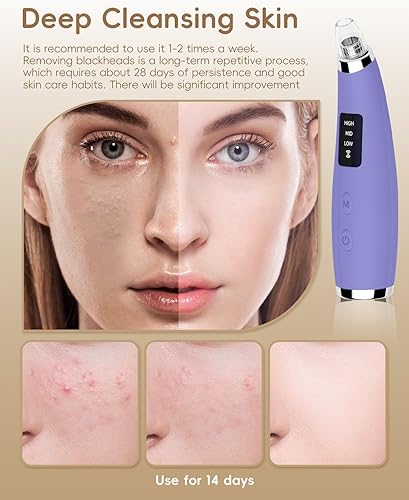 Miniatura 3 de Aspiradora facial para eliminar puntos negros, limpiador de poros y extractor de puntos negros con 3 niveles de succión ajustables, 5 sondas, kit de