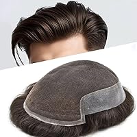 Vista 55 de FACE MIRACLE - Tupé frontal de encaje francés para hombres, sistema de reemplazo de cabello humano de encaje con pieza de pelo de poliuretano