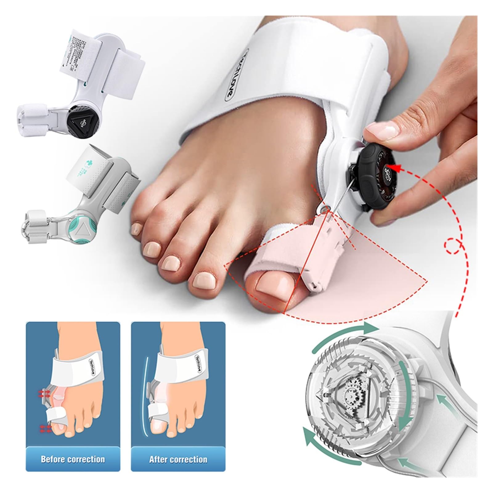 Corrector de férula ajustable para juanetes con perilla para corrección de hallux valgus, suministros ortopédicos para el cuidado de la pedicura (2 unidades)