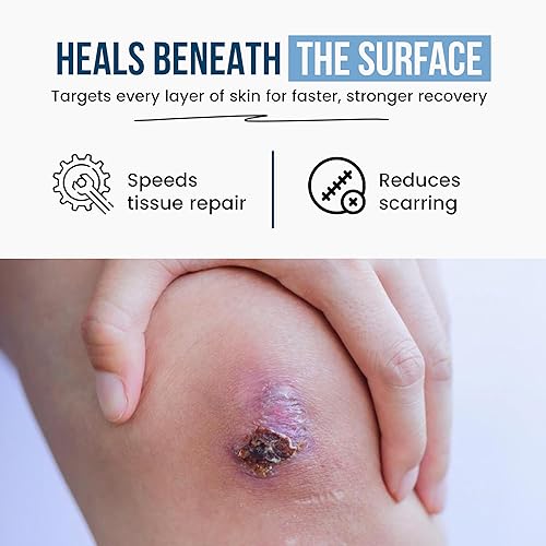 Miniatura 9 de Wound Care Plus Suplemento Complejo de Colágeno  Péptidos de Colágeno Multi-Fuente (Bovino, Marino, Pollo, Cáscara de huevo)  Apoya la salud de la