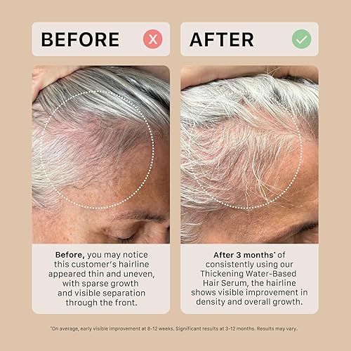 Miniatura 7 de ACTIIV Ultimate Power Trio para mujer  Estimula el cabello de aspecto más completo, fortalece, calma el cuero cabelludo, incluye champú,