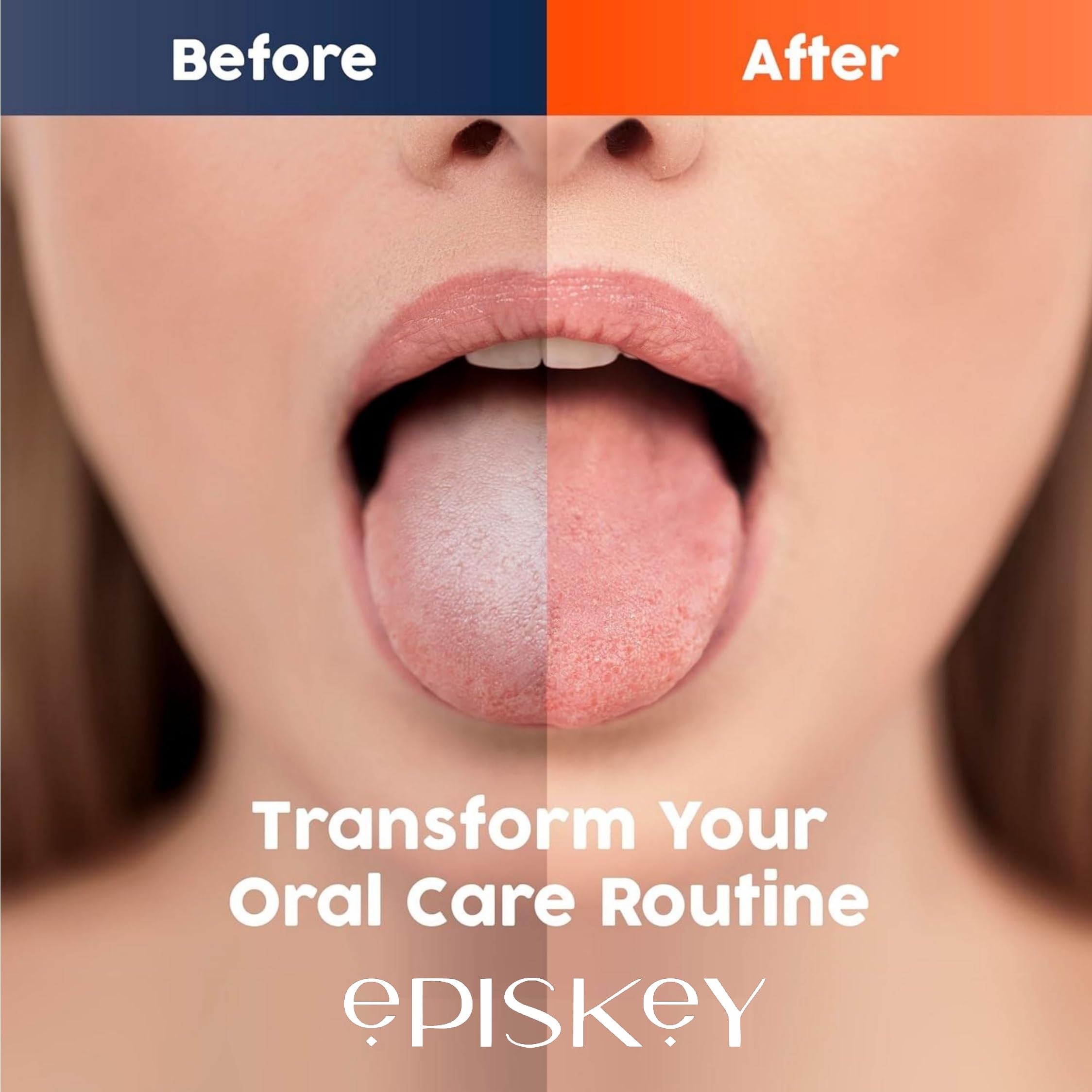 EPISKEY Tongue Scraper (1 Pack), Tongue Cleaner for Adults for Better Breath, Durable Stainless Steel Tongue Scrapers, Easy-to-Clean Tongue Scraper Cleaner Tools for Men and Women (STL_TNG_1) 1
