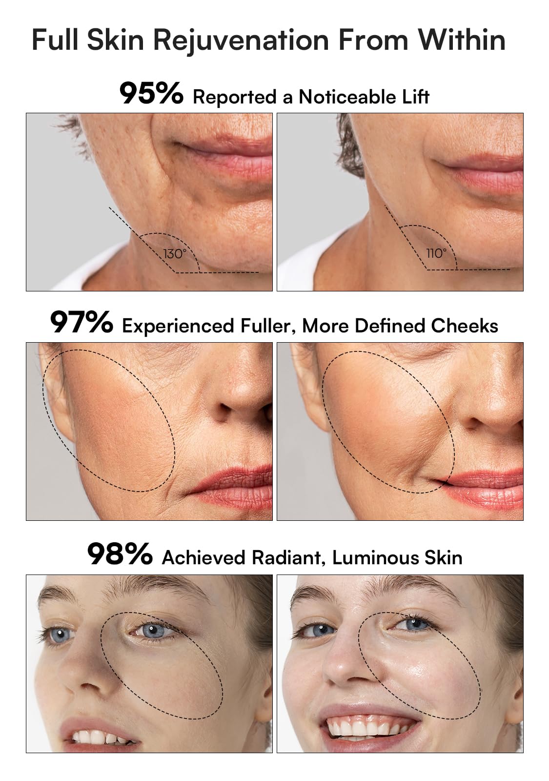 INIA 3-in-1 Skin Tightening Device True Beauty Glow Facial Massager Red Light Therapy for Face and Neck