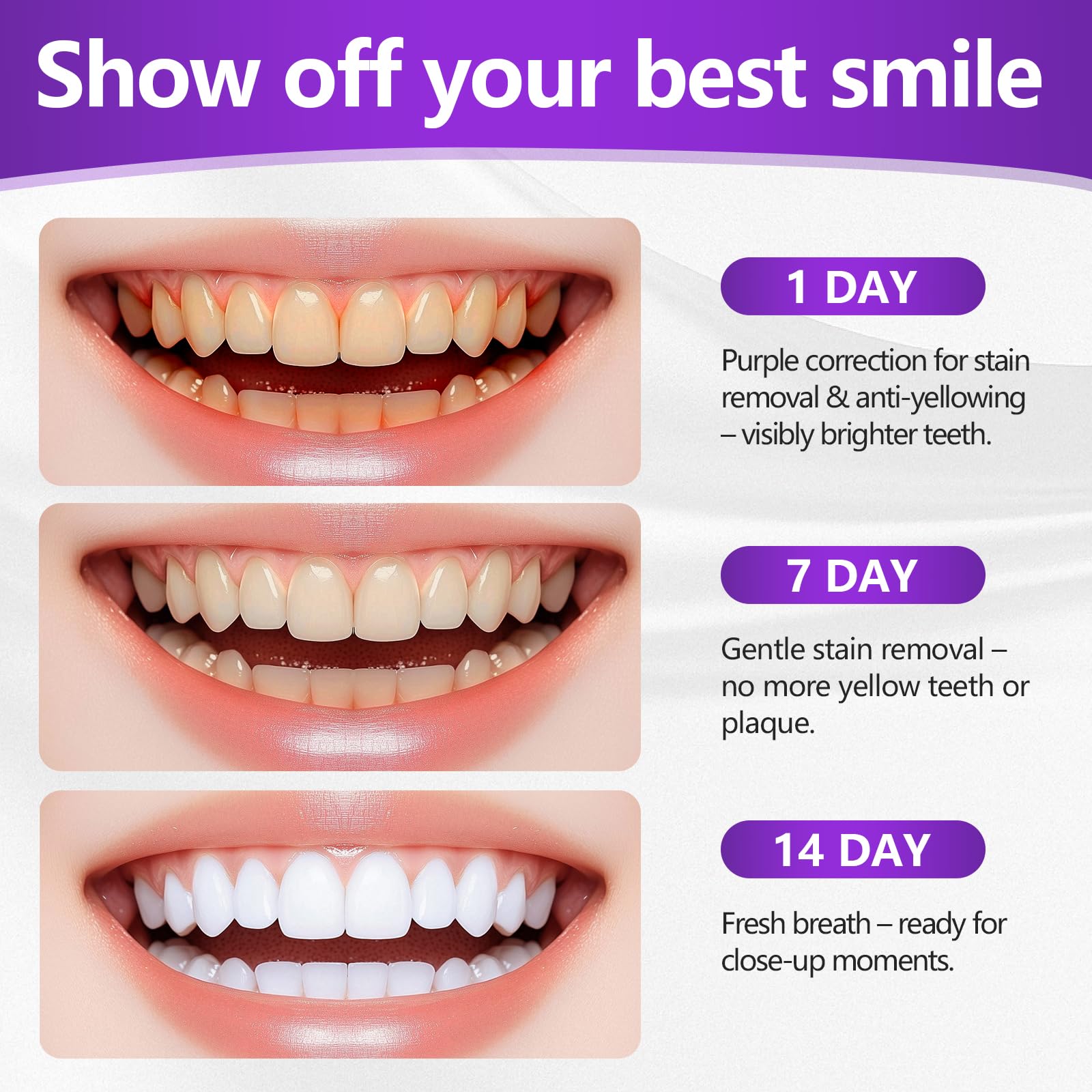14 Piezas Tiras Blanqueadoras Moradas, Tiras Blanqueadoras Antideslizantes, Strips Profesionales De Blanqueamiento De Dientes, Para El Café Y Otras Manchas, Ilumina La Sonrisa — view 3