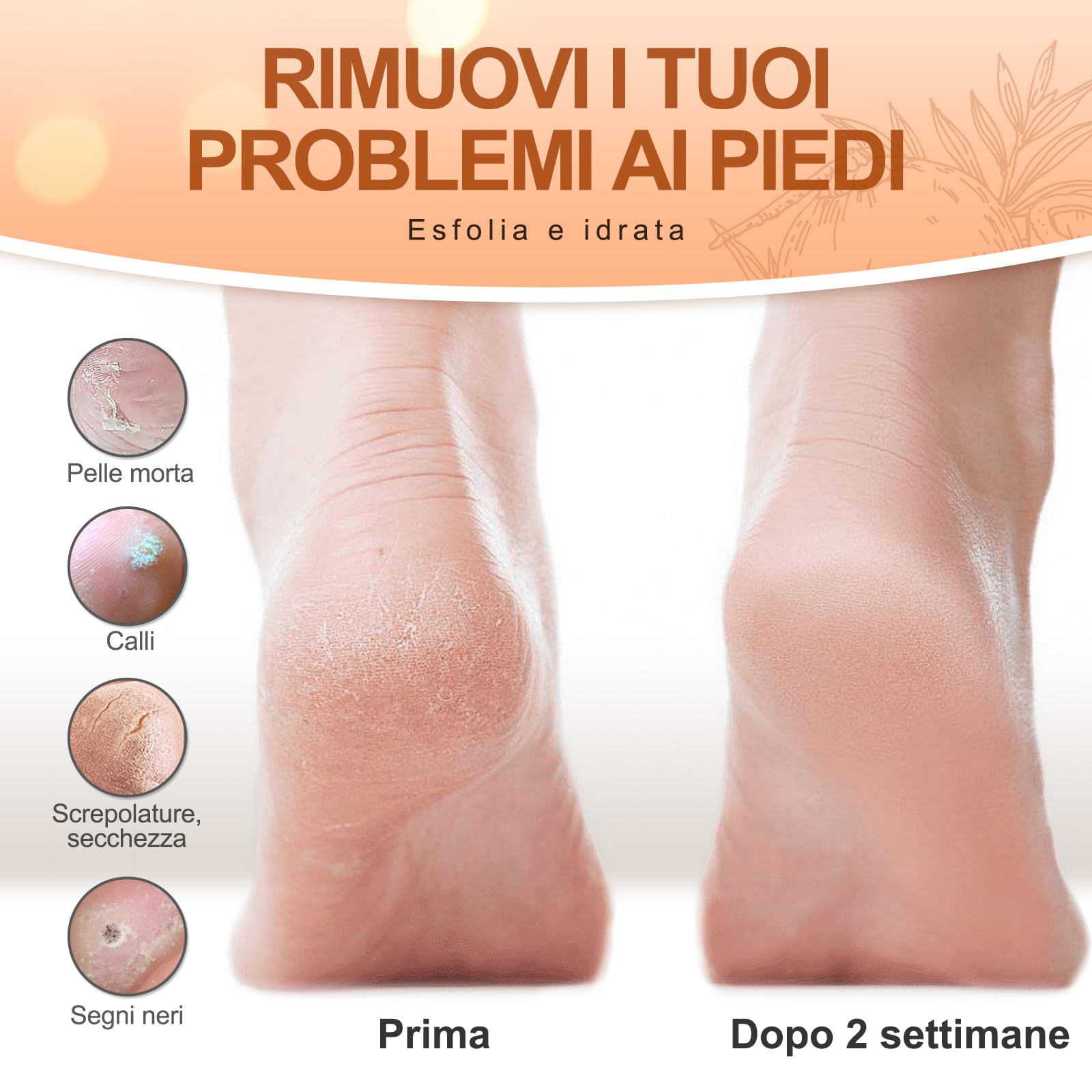 LA.PERSONAL Maschere Piedi 5 paia Peeling Piedi con Raspa Piedi e Calzini, Maschera Esfoliante Piede, Lisci e Morbidi, Maschere Piede Idratante Per Tallone Secchi Screpolati, Pelle morta e Calli