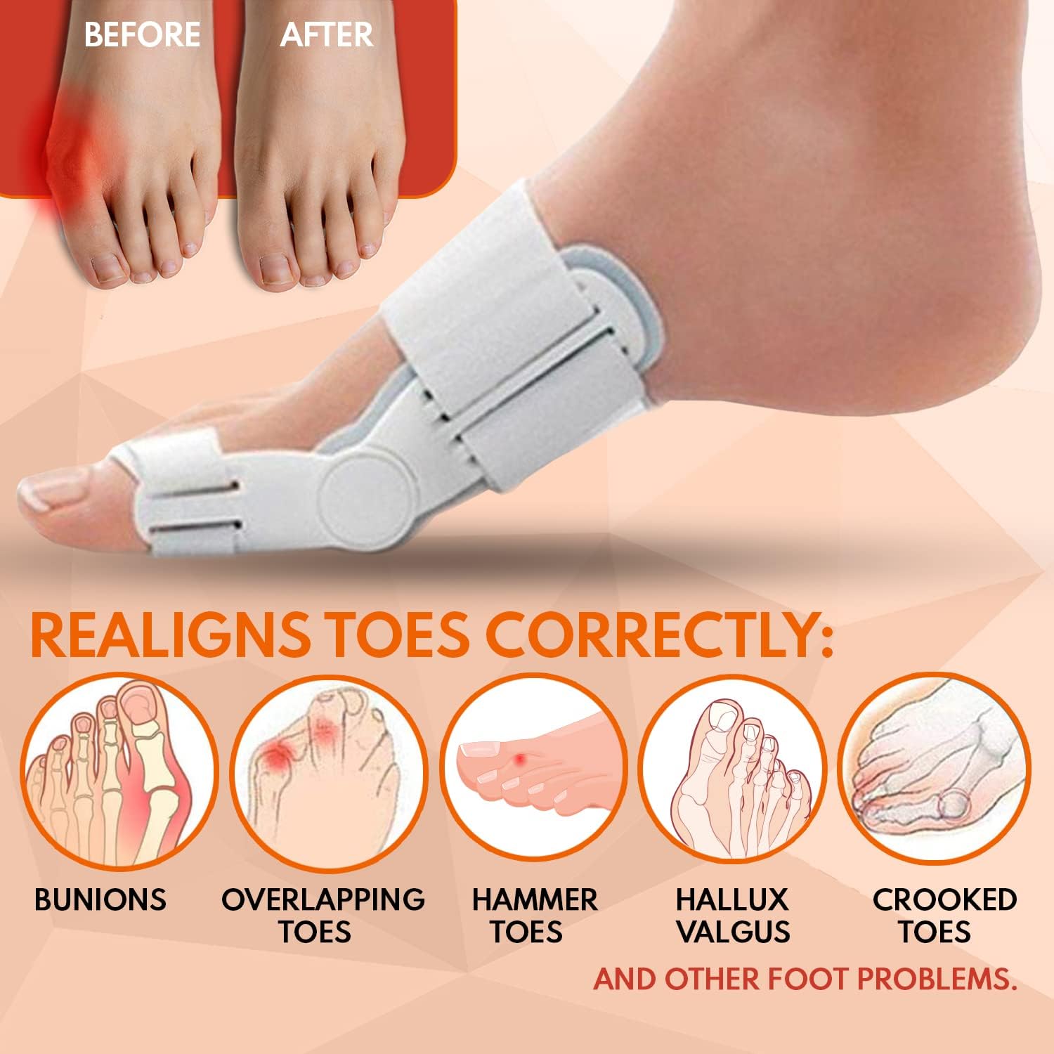 Bunion Corrector and Bunion Relief Orthopedic Bunion Splint Pads for Men and Women Hammer Toe Straightener and Bunion Protector Cushions- Relieve Hallux Valgus Foot Pain and Soothe Sore Bunions : Health & Household