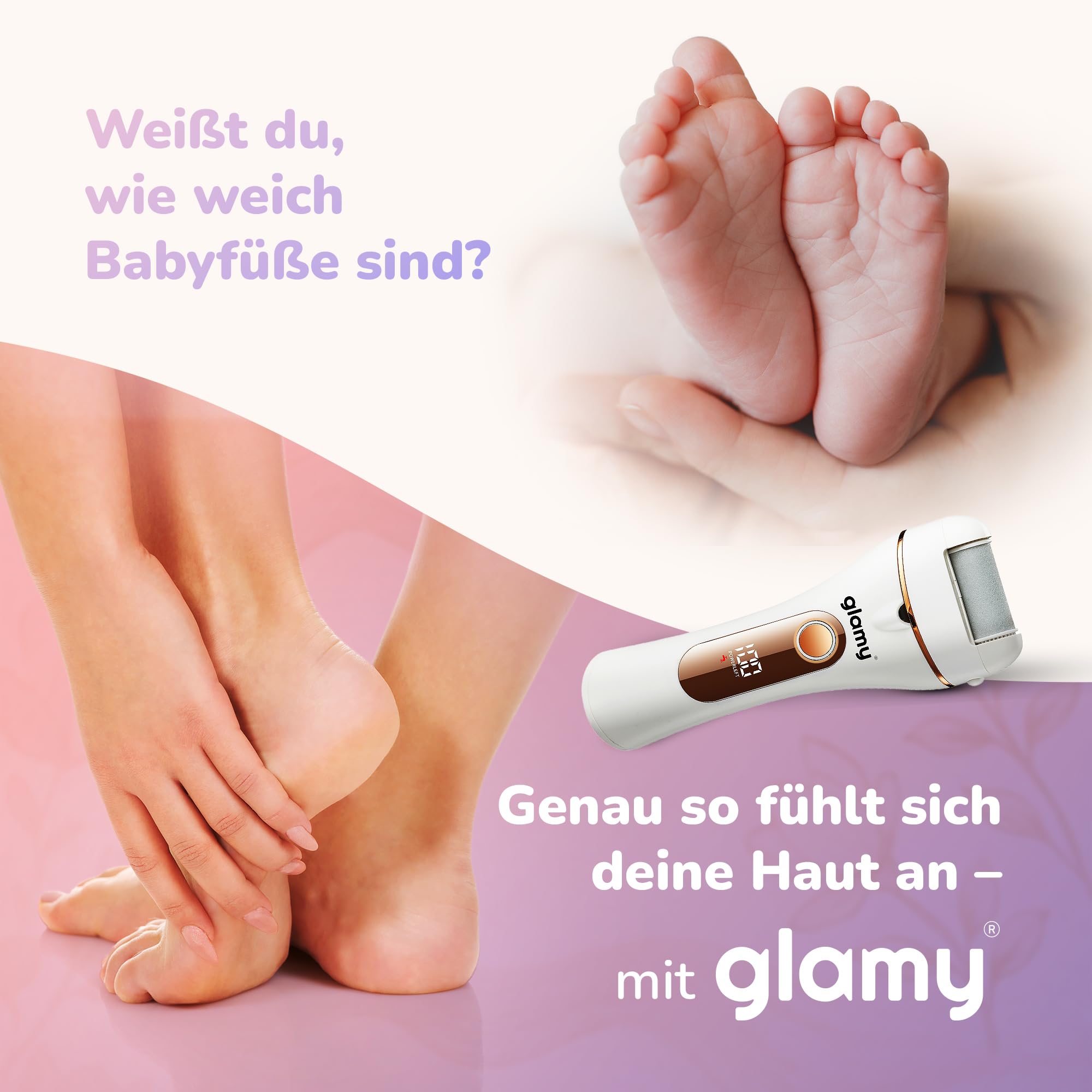 Elektrischer Hornhautentferner mit 5 Ersatzrollen, IPX6 wasserdicht, LED-Licht, 2 Stufen & Druck-Stopp, USB-C wiederaufladbar, inkl. Bimsstein