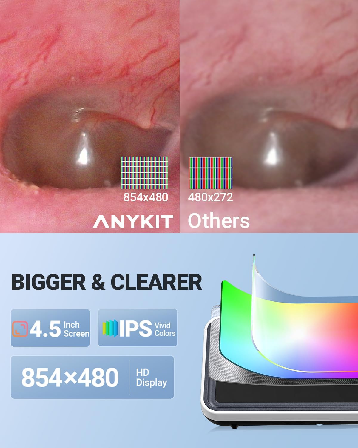 Anykit Digital Otoscope with Gyroscope, 4.5 Inches Screen, 3.9mm Ear Scope Camera with 6 Lights, Ear Wax Removal Tool, 32GB Card, Supports Photo Snap and Video Recording