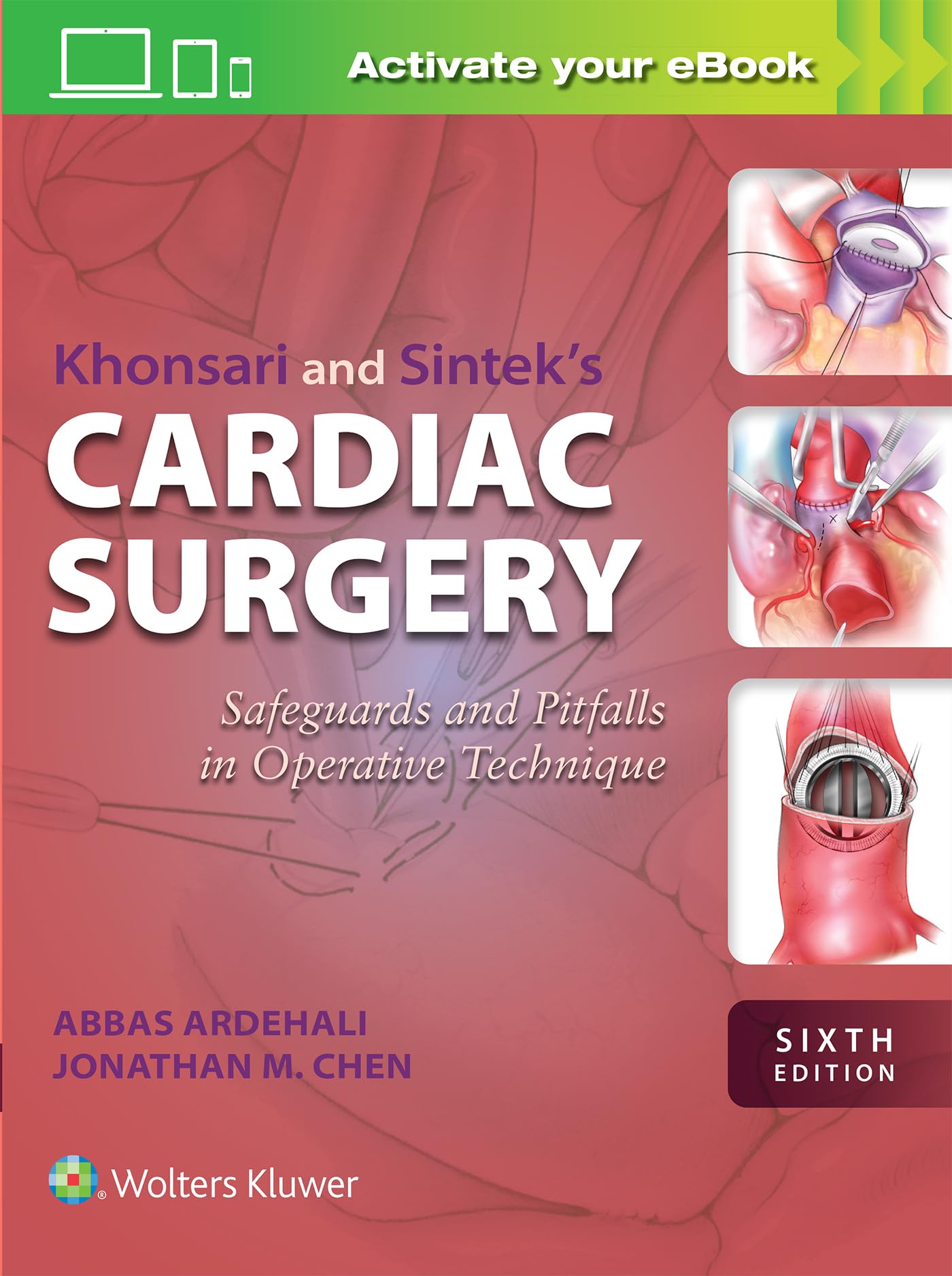 健康・医学 Khonsari's Cardiac Surgery Khonsari's Cardiac Surgery: Safeguards and Pitfalls in Operative
