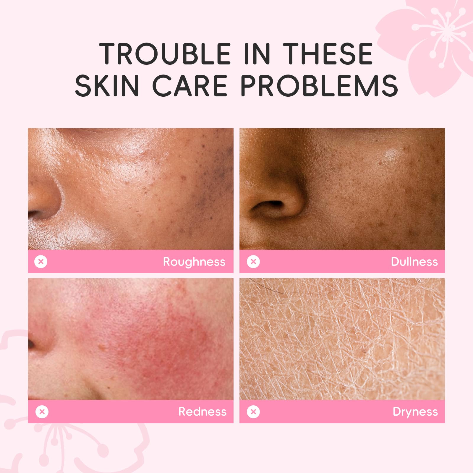 LAIKOU Sakura Face Mask Set - Image 3