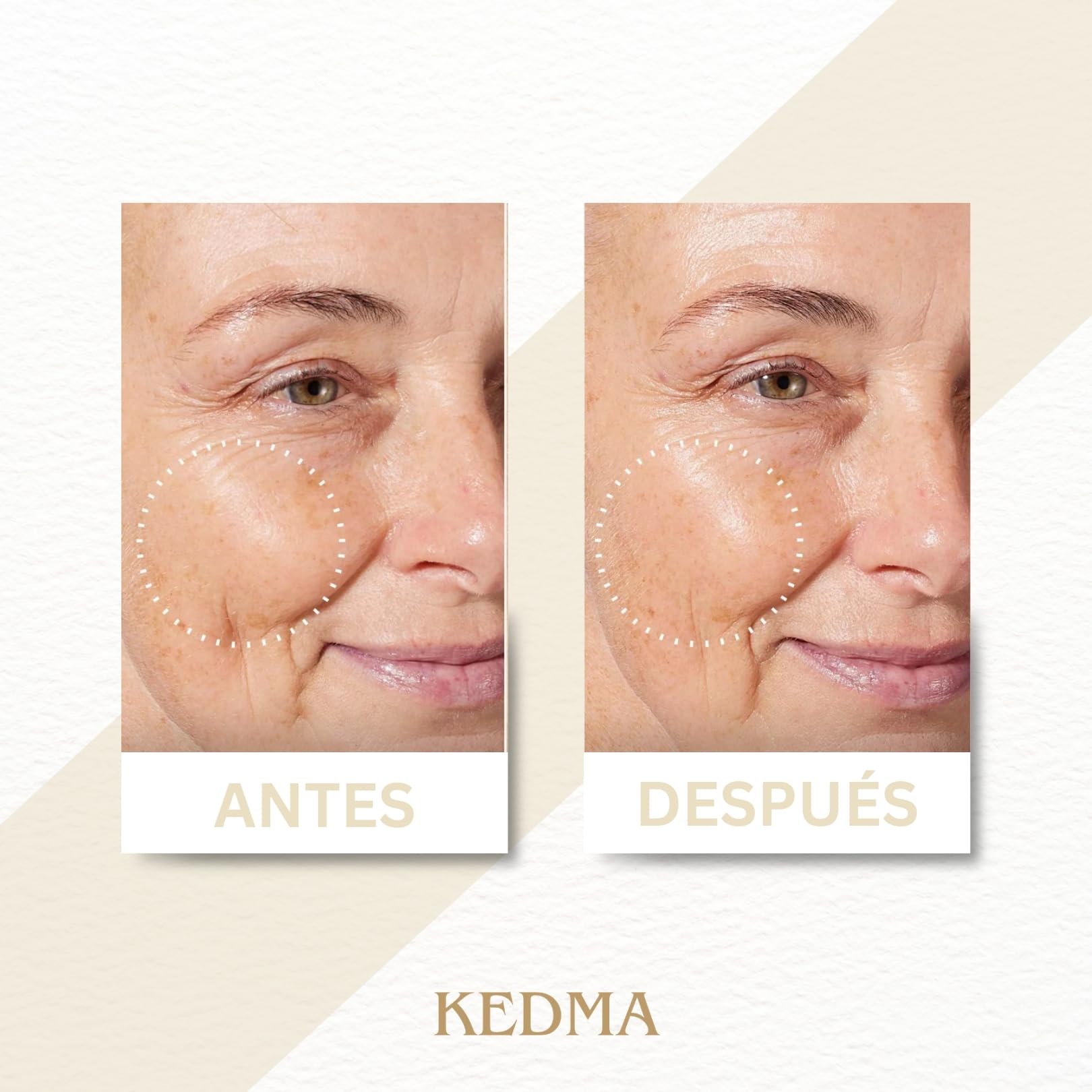 KEDMA - Crema de Día Protectora SPF 50+ - 50ml | La crema de día SPF 50+ ofrece protección UVA/UVB muy alta con una textura ligera y no grasa.