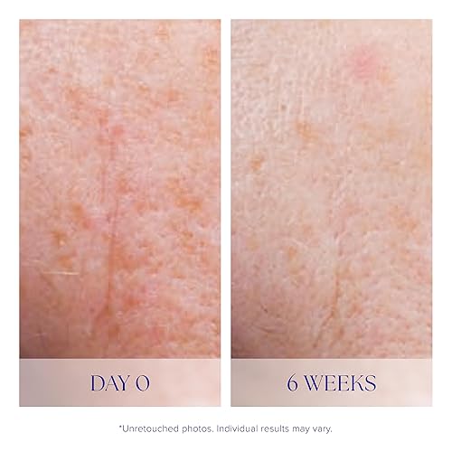 Miniatura 5 de iS CLINICAL Suero activo unifica visiblemente el tono de la piel, excelente para pieles propensas al acné, suero facial antienvejecimiento