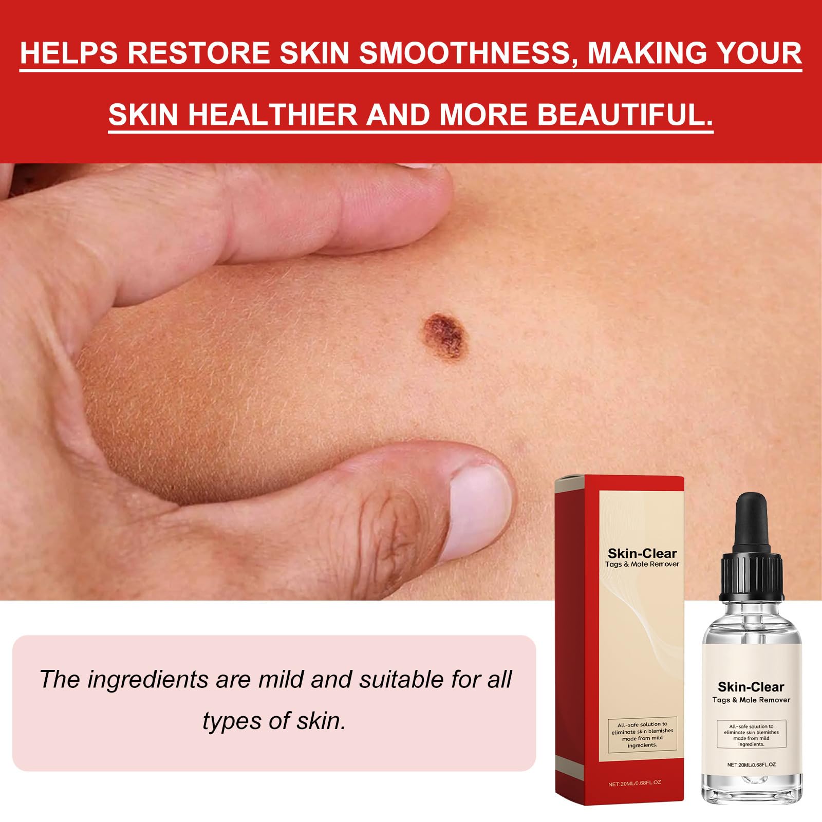Lotion pour Enlever les Taches Noires de Naevus et les Taches Sombres, Crème Anti-Taupes et Verrues, 20 ml