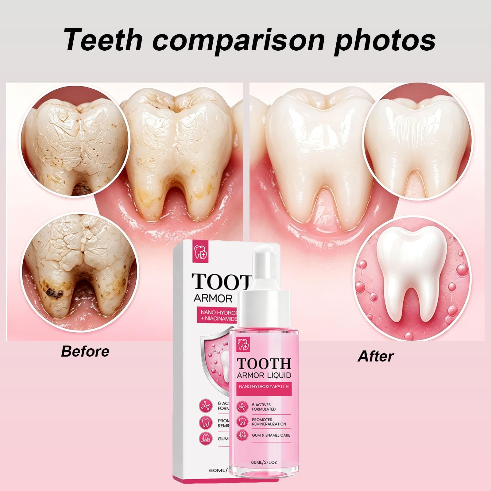 Tooth Armor Liquid Drops mit Nano Hydroxyapatite, Stärkung des Zahnschmelzes und sanfte tägliche Mundpflege für empfindliche Zähne, fluoridfreier Atemerfrischer (10PCS)