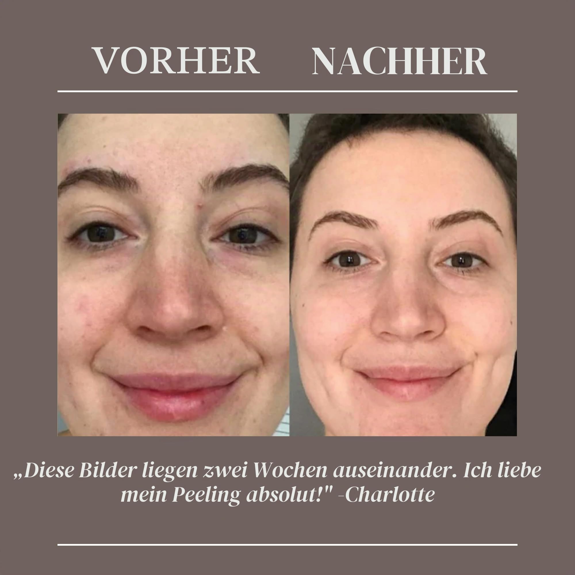 UpCircle Kaffee-Gesichtspeeling – Zitrusmischung für normale und trockene Haut 100 ml – Sheabutter, Kokosnuss + Hagebuttenöl – natürliches, veganes Gesichtspeeling für weiche, glatte Haut