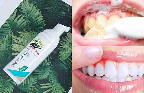 Miniatura 3 de Fórmula avanzada de blanqueamiento de dientes suave, removedor de manchas de dientes para blanquear los dientes. Anticavidad, fortalecer el esmalte